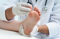 Causes and Symptoms of Athlete’s Foot