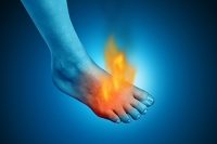 Burning Foot Pain May Signal Morton’s Neuroma